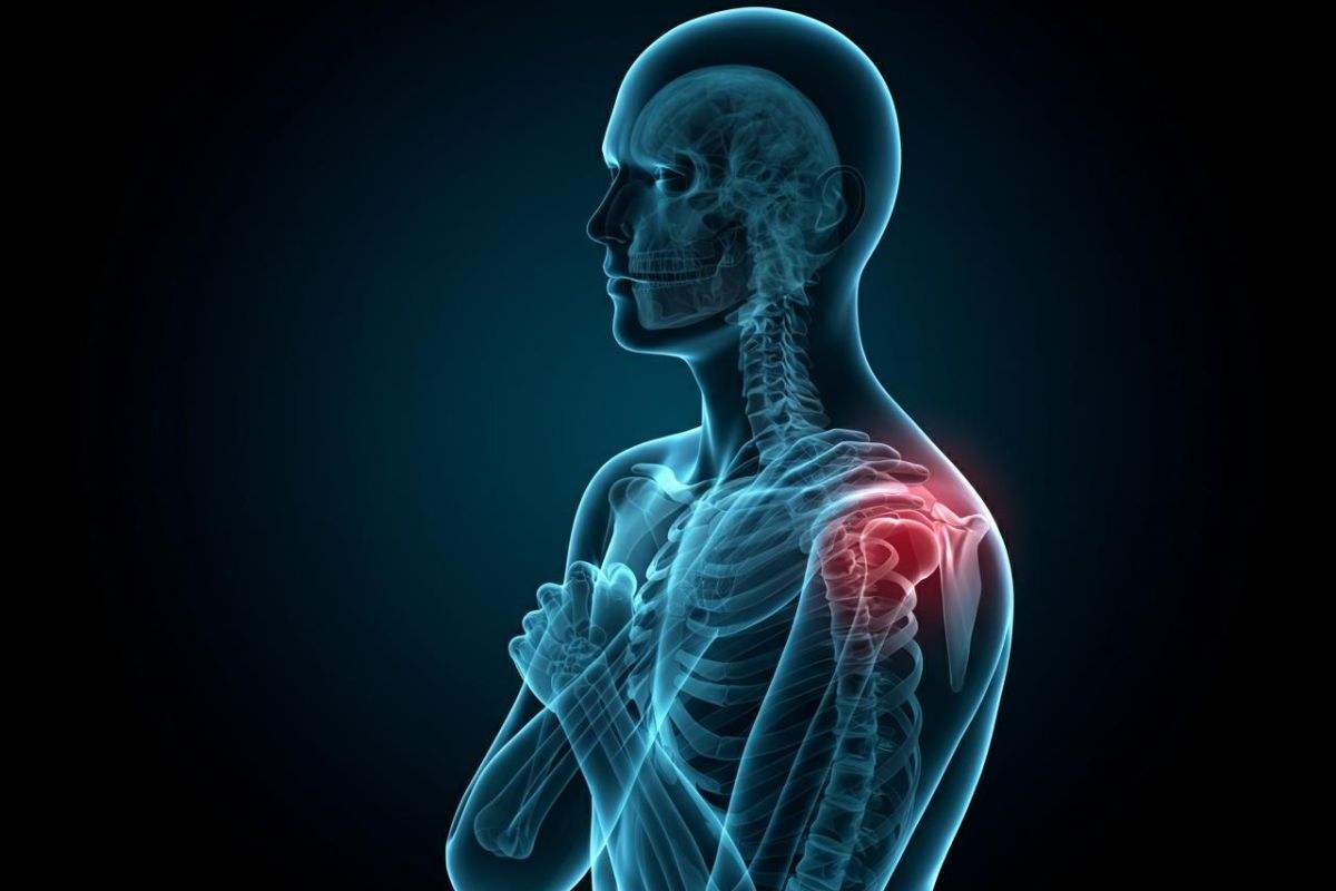 Dolore alla spalla, diagnosi