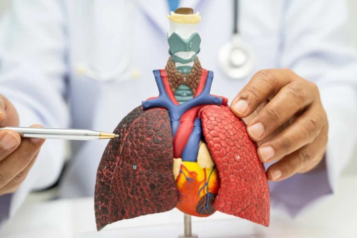 Il tumore ai polmoni